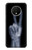 S3101 X-ray Peace Sign Fingers Case Cover Custodia per OnePlus 7T