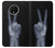 S3101 X-ray Peace Sign Fingers Case Cover Custodia per OnePlus 7T