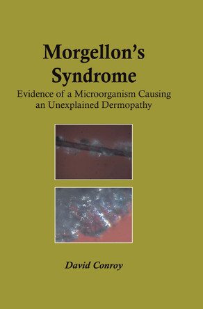 Morgellon's Syndrome by David Conroy 9781578086733