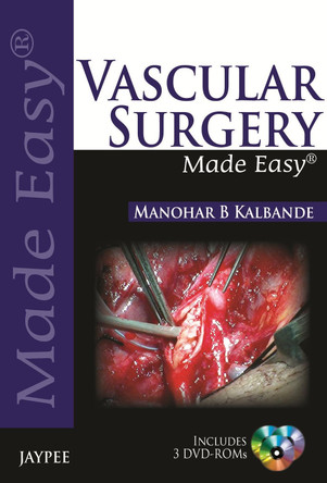 Vascular Surgery Made Easy by Manohar B Kalbande 9789350903940