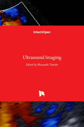Ultrasound Imaging by Masayuki Tanabe 9789533072395