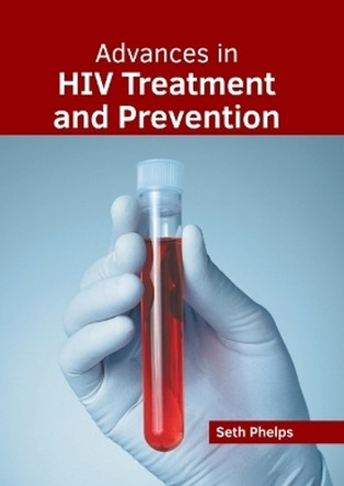 Advances in HIV Treatment and Prevention by Seth Phelps 9781639278572