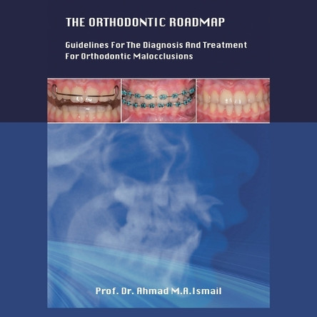 The Orthodontic Roadmap: Guidelines for the Diagnosis and Treatment of Orthodontic Malocclusions by Dr Prof Ahmad M a Ismail 9781543774764