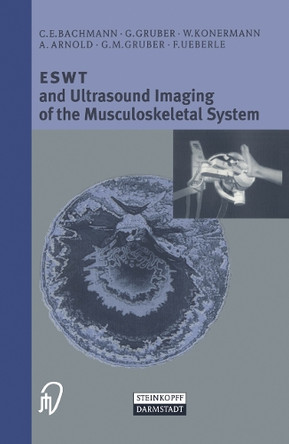ESWT and Ultrasound Imaging of the Musculoskeletal System by C.E. Bachmann 9783798512528