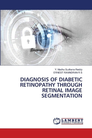 Diagnosis of Diabetic Retinopathy Through Retinal Image Segmentation by Y Madhu Sudhana Reddy 9786207475551
