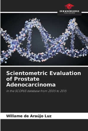 Scientometric Evaluation of Prostate Adenocarcinoma by Willame de Araújo Luz 9786207894987