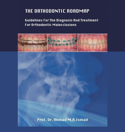 The Orthodontic Roadmap: Guidelines for the Diagnosis and Treatment of Orthodontic Malocclusions by Dr Prof Ahmad M a Ismail 9781543774757