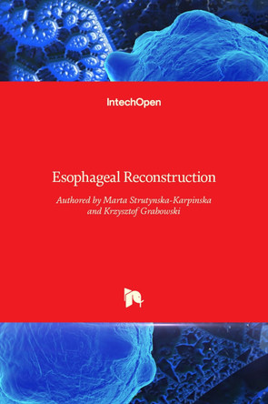 Esophageal Reconstruction by Marta Strutyńska-Karpińska 9789535106678