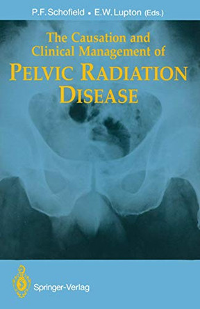 The Causation and Clinical Management of Pelvic Radiation Disease by P.F. Schofield 9781447117063