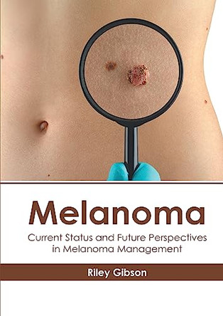 Melanoma: Current Status and Future Perspectives in Melanoma Management by Riley Gibson 9781632418784