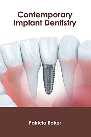 Contemporary Implant Dentistry by Patricia Baker 9781632426109