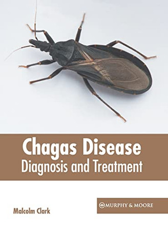 Chagas Disease: Diagnosis and Treatment by Malcolm Clark 9781639871001