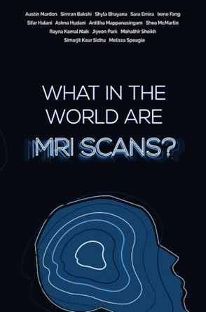 What in the world are MRI Scans? by Austin Mardon 9781773692272