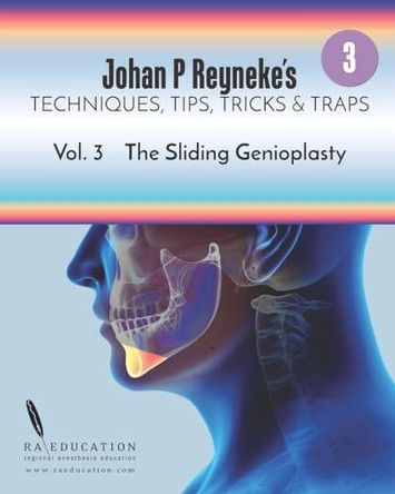 Johan P. Reyneke's Techniques, Tips, Tricks and Traps Vol 3: The Sliding Genioplasty by Johan P Reyneke 9781948083195