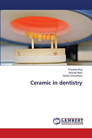 Ceramic in dentistry by Priyanka Roy 9786203465082