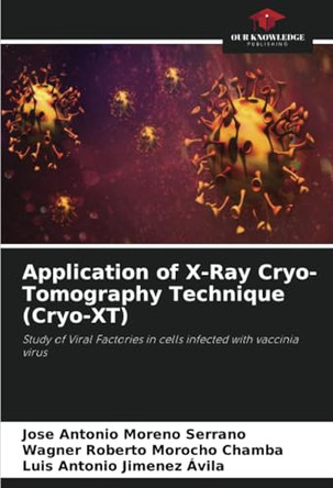 Application of X-Ray Cryo-Tomography Technique (Cryo-XT) by Jose Antonio Moreno Serrano 9786207701155