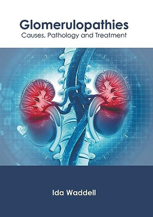 Glomerulopathies: Causes, Pathology and Treatment by Ida Waddell 9798887401362