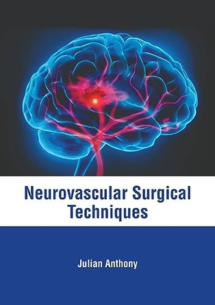 Neurovascular Surgical Techniques by Julian Anthony 9798887403205