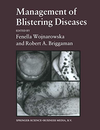 Management of Blistering Diseases by Robert A. Briggaman Fenella Wojnarowska 9780412289903