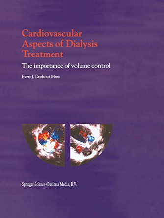 Cardiovascular Aspects of Dialysis Treatment: The importance of volume control by Mees Evert J. Dorhout 9780792362678