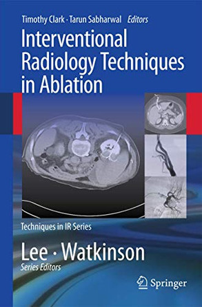 Interventional Radiology Techniques in Ablation by Timothy Clark 9780857290939