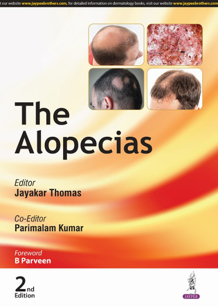 The Alopecias by Jayakar Thomas 9789366168678