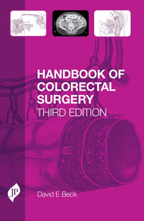 Handbook of Colorectal Surgery: Third Edition by David Beck 9781907816208