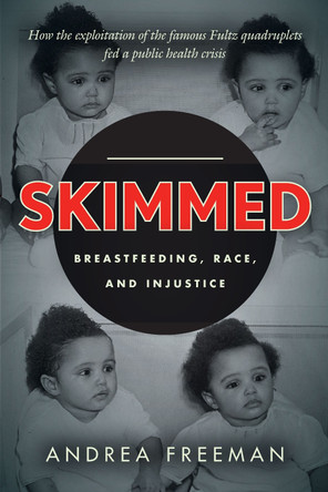 Skimmed: Breastfeeding, Race, and Injustice by Andrea Freeman 9781503628960
