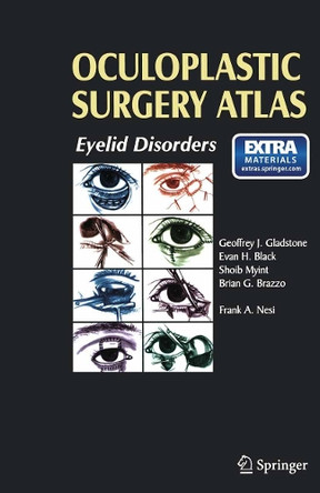 Oculoplastic Surgery Atlas: Eyelid Disorders by Frank A. Nesi 9783540781066