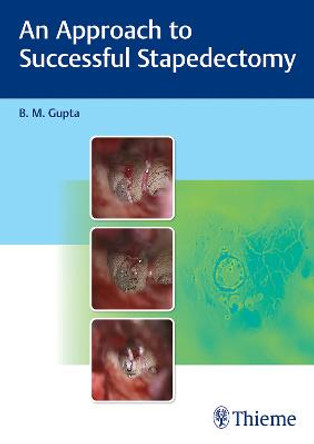 An Approach to Successful Stapedectomy by B Gupta