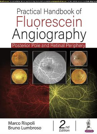 Practical Handbook of Fluorescein Angiography: Posterior Pole and Retinal Periphery by Marco Rispoli