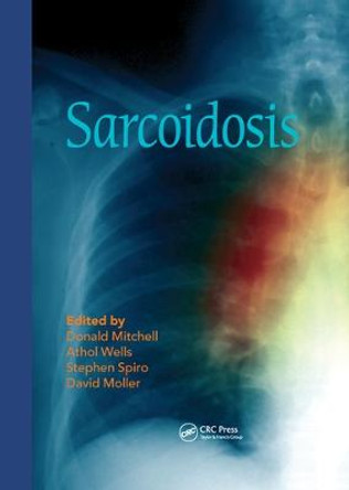 Sarcoidosis by Donald Mitchell