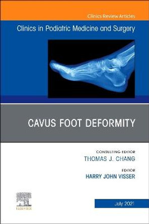 Cavus Foot Deformity, an Issue of Clinics in Podiatric Medicine and Surgery by Visser