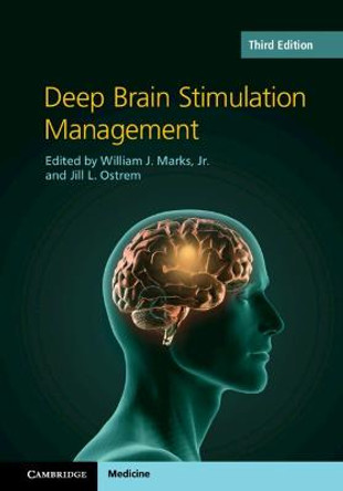 Deep Brain Stimulation Management by William J. Marks, Jr.