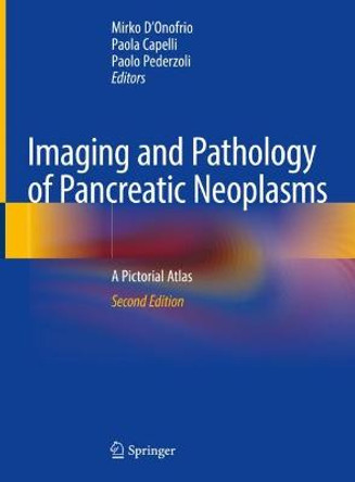 Imaging and Pathology of Pancreatic Neoplasms: A Pictorial Atlas by Mirko D'Onofrio