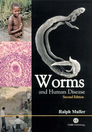Worms and Human Disease by Ralph Muller