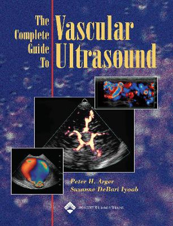 The Complete Guide to Vascular Ultrasound by Peter H. Arger