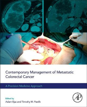 Contemporary Management of Metastatic Colorectal Cancer: A Precision Medicine Approach by Aslam Ejaz