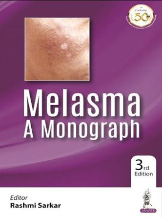 Melasma: A Monograph by Rashmi Sarkar