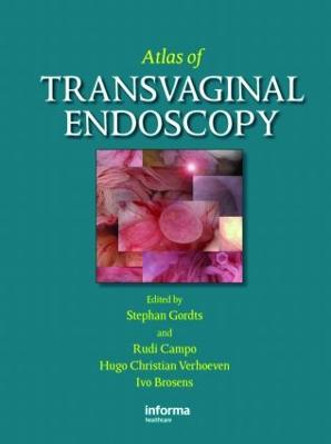 Atlas of Transvaginal Endoscopy by Stephan Gordts