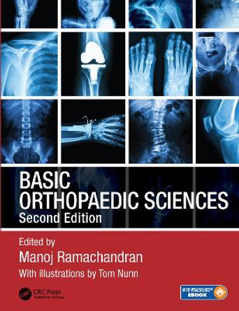 Basic Orthopaedic Sciences by Manoj Ramachandran