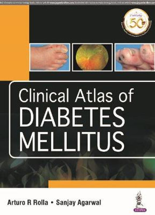 Clinical Atlas of Diabetes Mellitus by Arturo R Rolla