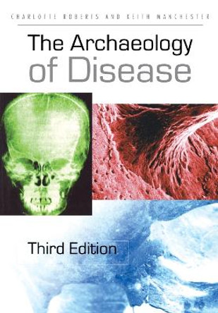 The Archaeology of Disease by Charlotte Roberts