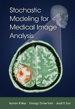 Stochastic Modeling for Medical Image Analysis by Ayman El-Baz