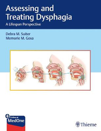 Assessing and Treating Dysphagia: A Lifespan Perspective by Debra Suiter