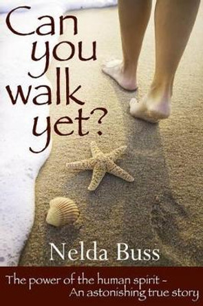 Can You Walk Yet? by Nelda Buss