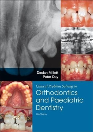 Clinical Problem Solving in Dentistry: Orthodontics and Paediatric Dentistry by Declan T. Millett