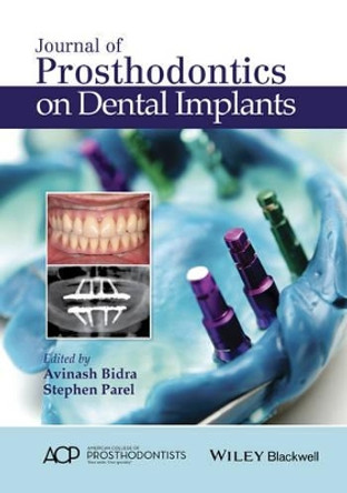 Journal of Prosthodontics on Dental Implants by Stephen M. Parel