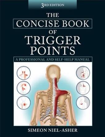 The Concise Book of Trigger Points by Simeon Niel-Asher