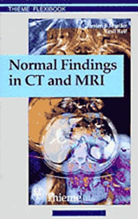 Normal Findings in CT and MRI, A1, print: . Zus.-Arb.: Torsten B. Moeller, Emil R. Reif 210 Illustrations by Torsten Bert Moeller 9783131165213